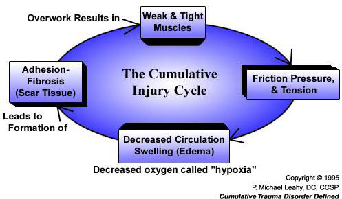 Chiropractic Burke VA Cumulative Injury Cycle Chart
