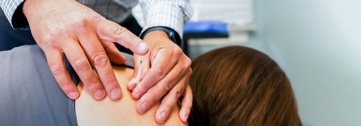 Chiropractor Burke VA Todd Sullivan Administering Dry Needling